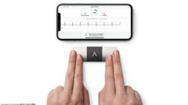  EKG Monitor