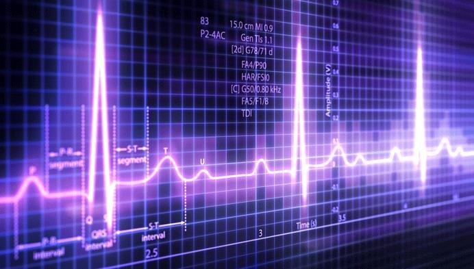 AI Improves EKG Monitor